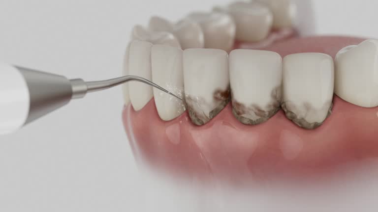 Reliable Dental contractor in Brookston, IN by Dentist Open Now